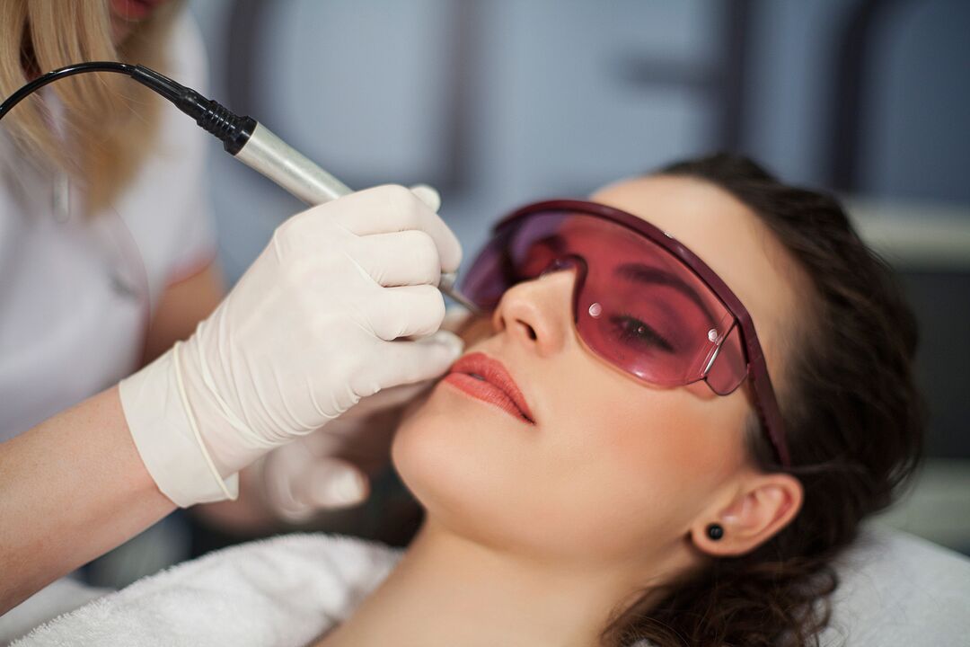 lasertophorèse pour le rajeunissement de la peau