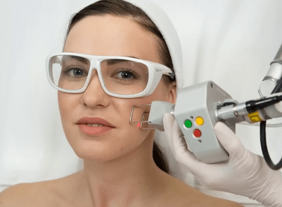 Rajeunissement du laser sur le terrain