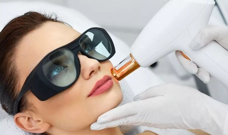 Rajeunissement au laser de la peau