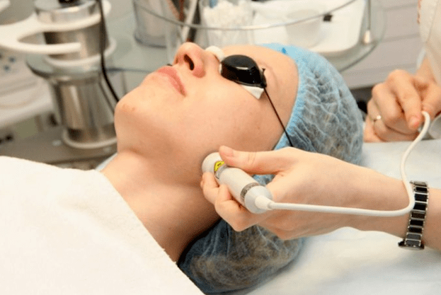 Biorevitisation laser