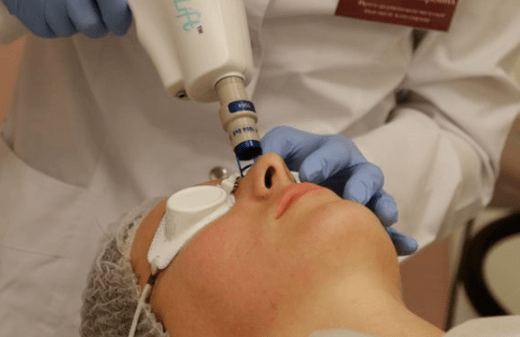Rajeunissement laser non qualifié