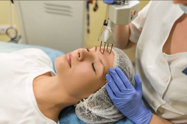 processus de rajeunissement du visage au laser